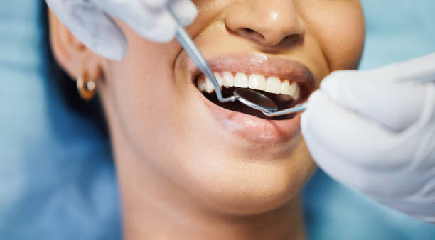 Best Dental Abscess Treatment in Derby, CT